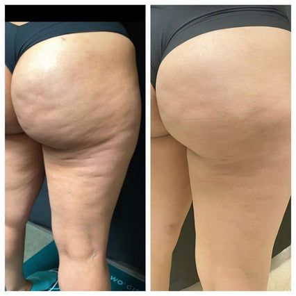 Customer result